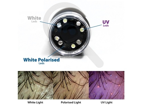  LED Dermatoscope With Polarized Filter 
