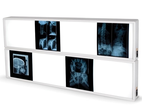 X-Ray Film Viewer 2 x 3 Panels